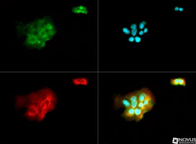 Immunocytochemistry/Immunofluorescence: CYLD Antibody [NB110-95574] - CYLD antibody was tested in A431 cells with DyLight 488 (green). Nuclei and alpha-tubulin were counterstained with DAPI (blue) and Dylight 550 (red).