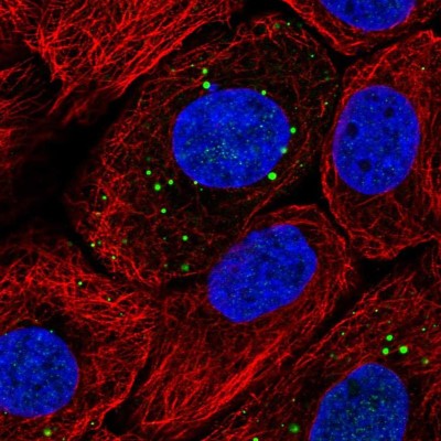 Immunocytochemistry/Immunofluorescence: Filaggrin Antibody [NBP1-87528] - Immunofluorescent staining of human cell line HaCaT shows localization to vesicles.