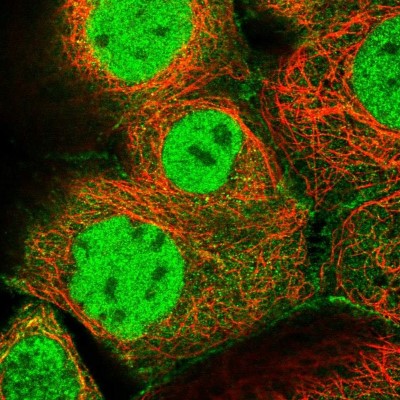 Immunocytochemistry/Immunofluorescence: MCMBP Antibody [NBP1-90746] - Immunofluorescent staining of human cell line A-431 shows localization to nucleoplasm, plasma membrane & cytosol.