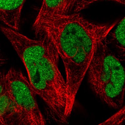 Immunocytochemistry/Immunofluorescence: ZEB1 Antibody (CL0151) [NBP2-52866] - Staining in RH30 cell line with Anti-ZEB1 monoclonal antibody, showing nuclear (without nucleoli) staining in green. Microtubule probes are visualized in red (where available).