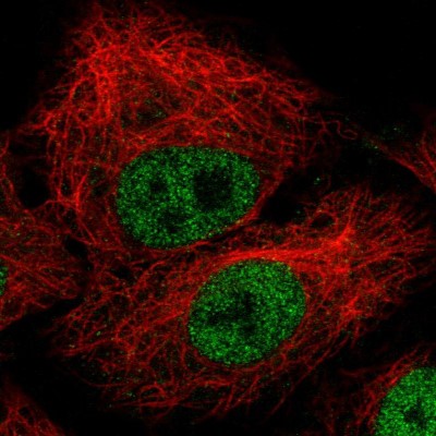 Immunocytochemistry/Immunofluorescence: ZEB1 Antibody (CL0151) [NBP2-52866] - Staining in A549 cell line with Anti-ZEB1 monoclonal antibody, showing nuclear (without nucleoli) staining in green. Microtubule probes are visualized in red (where available).