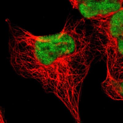 Immunocytochemistry/Immunofluorescence: AUTS2 Antibody [NBP1-84717] - Immunofluorescent staining of human cell line A-431 shows localization to nucleoplasm.