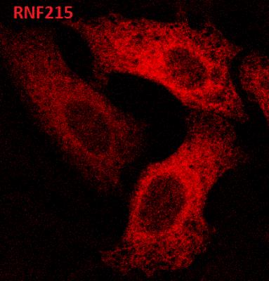 Immunocytochemistry/Immunofluorescence: RNF215 Antibody [NBP1-92342] - Staining of CFBE41o- cells. Image from verified customer review.