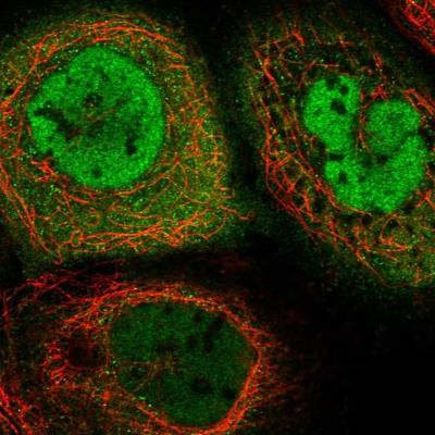 Immunocytochemistry/Immunofluorescence: CENPV Antibody [NBP1-84545] - Staining of human cell line A-431 shows positivity in cytoplasm and  nucleus but excluded from the nucleoli.