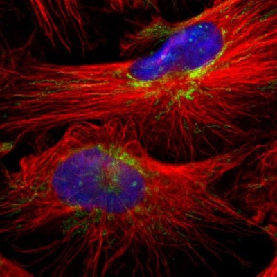 Immunocytochemistry/Immunofluorescence: MRPL40 Antibody [NBP1-82620] - Immunofluorescent staining of human cell line U-251 MG shows localization to nucleoli & mitochondria.