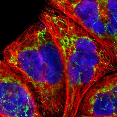 Immunocytochemistry/Immunofluorescence: SSBP1 Antibody [NBP1-80720] - Immunofluorescent staining of human cell line A-431 shows localization to mitochondria.