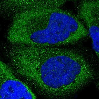Immunocytochemistry/Immunofluorescence: EIF5 Antibody [NBP1-86184] - Immunofluorescent staining of human cell line A-431 shows localization to cytosol.