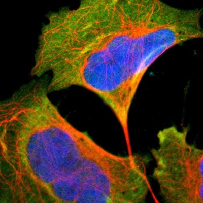 Immunofluorescence: EIF5 Antibody [NBP1-86184] - Staining  of human cell line U-2 OS shows positivity in cytoplasm.