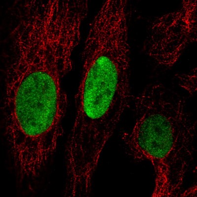 Immunocytochemistry/Immunofluorescence: Anillin Antibody (CL0303) [NBP2-52908] - Staining in U2OS cell line with Anti-ANLN monoclonal antibody, showing cell cycle dependent nuclear (without nucleoli) staining in green. Microtubule- and nuclear probes are visualized in red and blue respectively (where available).