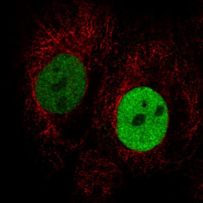 Immunocytochemistry/Immunofluorescence: Anillin Antibody (CL0303) [NBP2-52908] - Staining in A431 cell line with Anti-ANLN monoclonal antibody, showing cell cycle dependent nuclear (without nucleoli) staining in green. Microtubule- and nuclear probes are visualized in red and blue respectively (where available).