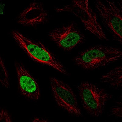 Immunocytochemistry/Immunofluorescence: Anillin Antibody (CL0303) [NBP2-52908] - Staining in HeLa cell line with Anti-ANLN monoclonal antibody, showing cell cycle dependent nuclear (without nucleoli) staining in green. Microtubule- and nuclear probes are visualized in red and blue respectively (where available).