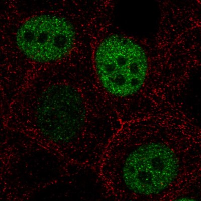 Immunocytochemistry/Immunofluorescence: Anillin Antibody (CL0303) [NBP2-52908] - Staining in MCF7 cell line with Anti-ANLN monoclonal antibody, showing cell cycle dependent nuclear (without nucleoli) staining in green. Microtubule- and nuclear probes are visualized in red and blue respectively (where available).