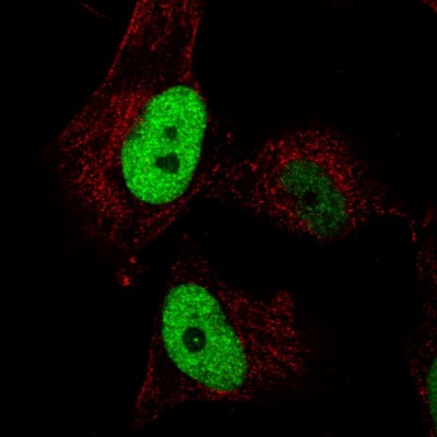 Immunocytochemistry/Immunofluorescence: Anillin Antibody (CL0303) [NBP2-52908] - Staining in U251 cell line with Anti-ANLN monoclonal antibody, showing cell cycle dependent nuclear (without nucleoli) staining in green. Microtubule- and nuclear probes are visualized in red and blue respectively (where available).