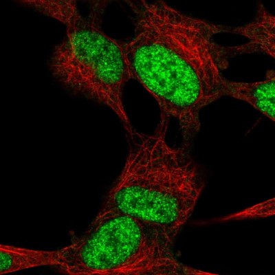 Immunocytochemistry/Immunofluorescence: ROBO2 Antibody [NBP1-81399] - Immunofluorescent staining of human cell line SH-SY5Y shows localization to nucleus.