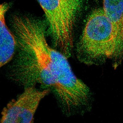 Immunocytochemistry/Immunofluorescence: PTK9 Antibody [NBP1-90297] - Immunofluorescent staining of human cell line U-251 MG shows localization to cytosol.