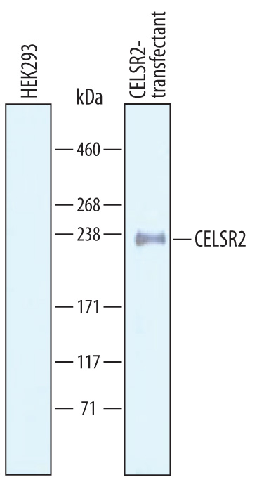 Western blot shows lysates of HEK293 human embryonic kidney cell line either mock transfected or transfected with human CELSR2. PVDF Membrane was probed with 1 µg/mL of Goat Anti-Human CELSR2 Antigen Affinity-purified Polyclonal Antibody (Catalog # AF6739) followed by HRP-conjugated Anti-Goat IgG Secondary Antibody (Catalog # HAF019). A specific band was detected for CELSR2 at approximately 240 kDa (as indicated). This experiment was conducted under reducing conditions and using Immunoblot Buffer Group 8.