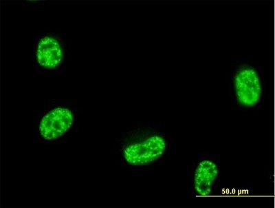Immunocytochemistry/Immunofluorescence: Septin-12 Antibody [H00124404-B01P] - Analysis of purified antibody to SEPT12 on HeLa cell. (antibody concentration 10 ug/ml)