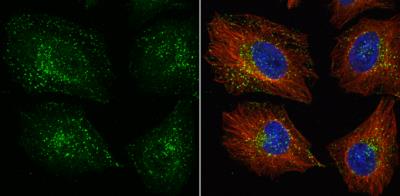 Immunocytochemistry/Immunofluorescence: VPS35 Antibody [NBP1-31069] - VPS35 antibody [C3], C-term detects VPS35 protein at cytoplasm by immunofluorescent analysis. Sample: HeLa cells were fixed in 4% paraformaldehyde at RT for 15 min. Green: VPS35 protein stained by VPS35 antibody [C3], C-term  diluted at 1:1000. Red: alpha Tubulin, a cytoskeleton marker, stained by alpha Tubulin antibody [B-5-1-2] diluted at 1:10000. Blue: Hoechst 33342 staining.