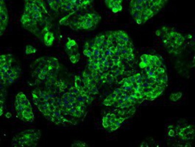 Immunocytochemistry/Immunofluorescence: GBE1 Antibody (1D11) [NBP2-02245] - Immunofluorescent staining of HepG2 cells using anti-GBE1 mouse monoclonal antibody.
