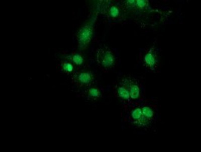 Immunocytochemistry/Immunofluorescence: SNX8 Antibody (1E5) [NBP2-03367] - Staining of COS7 cells transiently transfected by pCMV6-ENTRY SNX8.