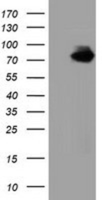 Western Blot: Breast cancer suppressor candidate 1 Antibody (3D6) [NBP2-02898] - HEK293T cells were transfected with the pCMV6-ENTRY control (Left lane) or pCMV6-ENTRY Breast cancer suppressor candidate 1 (Right lane) cDNA for 48 hrs and lysed. Equivalent amounts of cell lysates (5 ug per lane) were separated by SDS-PAGE and immunoblotted with anti-Breast cancer suppressor candidate 1.