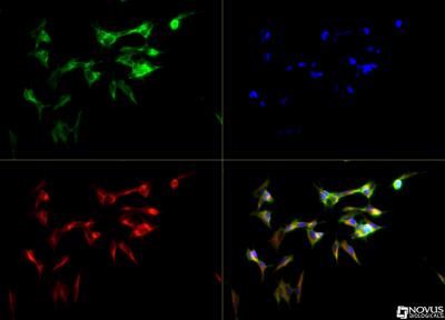 Immunocytochemistry/Immunofluorescence: CYP46A1 Antibody [NB400-140] - CYP46A1 antibody was tested in SH-SY5Y cells with DyLight 488 (green). Nuclei and alpha-tubulin were counterstained with DAPI (blue) and Dylight 550 (red).