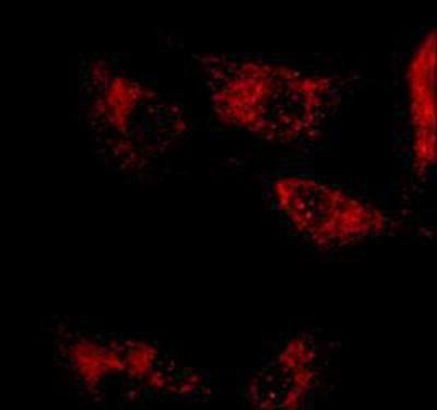 Immunocytochemistry/Immunofluorescence: alpha 1 Mannosidase 1A Antibody [NB600-977] - NRK cells were fixed and permeabilized with cold methanol followed by cold methanol:acetone (1:1). Fixed cells were stained with 10 ug/mL Rabbit Anti-a1,2-Mannosidase IA. The antibody was developed using Goat Anti-Rabbit IgG, Cy3 conjugate.