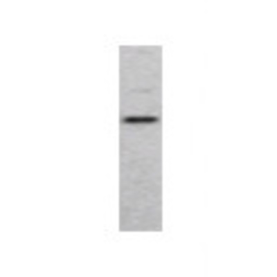 Western Blot: PALB2 Antibody [21340002] - Western Blot was performed using affinity purified SEQer PALB2 antibody, aa(99-198) antibody. The lanes contain 5-30ug of a whole cell extract.  Final concentration of antibodies = 0.1ug/ml (1:10,000 dilution). The blot was probed overnight with the SEQer PALB2 antibody, aa(99-198) antibody.  Blot was then washed according to protocol and probed with goat-anti-Rabbit-HRP conjugate at 1:5000 dilution, washed and developed using chemiluminescence (film exposure 5-30sec).  The protein was detected as represented by the band shown.
