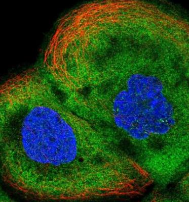 Immunocytochemistry/Immunofluorescence: ALDH1A3 Antibody [NBP1-91657] - Staining of human cell line A-431 shows positivity in plasma membrane and cytoplasm. Antibody staining is shown in green.
