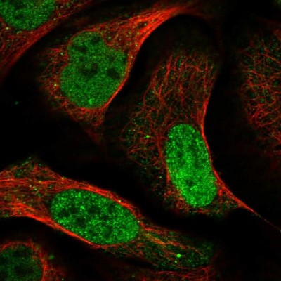 Immunocytochemistry/Immunofluorescence: KLF5 Antibody [NBP1-88508] - Immunofluorescent staining of human cell line U-2 OS shows localization to nucleoplasm & vesicles.