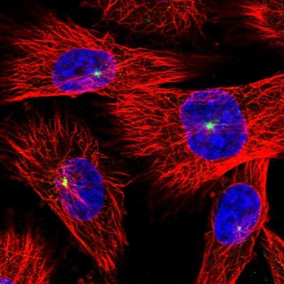 Immunocytochemistry/Immunofluorescence: alpha-N-acetylglucosaminidase/NAGLU Antibody [NBP1-82601] - Staining of human cell line U-251 MG shows positivity in centrosome.