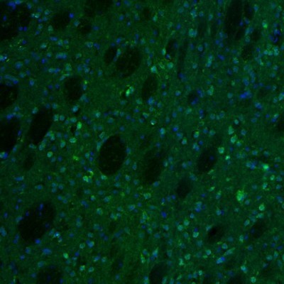 Immunocytochemistry/Immunofluorescence: alpha-N-acetylglucosaminidase/NAGLU Antibody [NBP1-82601] - Staining of mouse caudate putamen shows immunoreactivity in neurons.