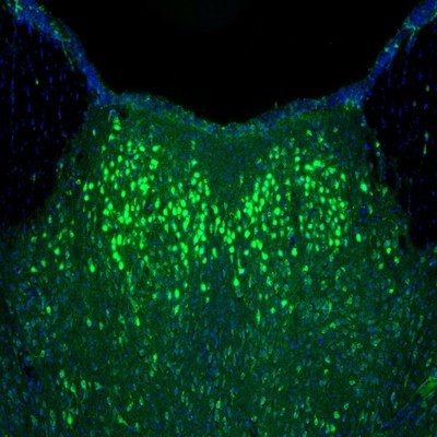 Immunocytochemistry/Immunofluorescence: alpha-N-acetylglucosaminidase/NAGLU Antibody [NBP1-82601] - Staining of mouse thalamus shows neuronal immunoreactivity in paraventricular thalamic nucleus.