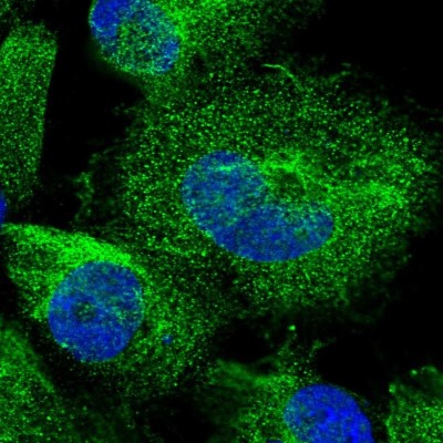 Immunocytochemistry/Immunofluorescence: OTUD3 Antibody [NBP1-90485] - Immunofluorescent staining of human cell line U-251 MG shows localization to cytosol & intermediate filaments.