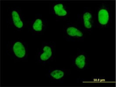 Immunocytochemistry/Immunofluorescence: POLD3 Antibody (3E2) [H00010714-M01] - Analysis of monoclonal antibody to POLD3 on HeLa cell. Antibody concentration 10 ug/ml.