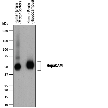 Western blot shows lysates of human brain (motor cortex) tissue and human brain (hippocampus) tissue. PVDF membrane was probed with 0.25 µg/mL of Mouse Anti-Human HepaCAM Monoclonal Antibody (Catalog # MAB4108) followed by HRP-conjugated Anti-Mouse IgG Secondary Antibody (Catalog # HAF018). A specific band was detected for HepaCAM at approximately 45-70 kDa (as indicated). This experiment was conducted under reducing conditions and using Immunoblot Buffer Group 1.