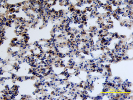 IL‑17 RD/SEF was detected in immersion fixed frozen sections of mouse lung using Mouse IL‑17 RD/SEF Monoclonal Antibody (Catalog # MAB2276) at 25 µg/mL overnight at 4 °C. Tissue was stained using the Anti-Rat HRP-DAB Cell & Tissue Staining Kit (brown; Catalog # CTS017) and counterstained with hematoxylin (blue). View our protocol for Chromogenic IHC Staining of Frozen Tissue Sections.