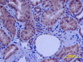 beta -Defensin 4/2 was detected in immersion fixed paraffin-embedded sections of human kidney array using Human  beta -Defensin 4/2 Antigen Affinity-purified Polyclonal Antibody (Catalog # AF2758) at 10 µg/mL overnight at 4 °C. Tissue was stained using the Anti-Goat HRP-DAB Cell & Tissue Staining Kit (brown; Catalog # CTS008) and counterstained with hematoxylin (blue). View our protocol for Chromogenic IHC Staining of Paraffin-embedded Tissue Sections.