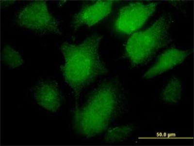 Immunocytochemistry/Immunofluorescence: PC1/3 Antibody (3D2) [H00005122-M02] - Analysis of monoclonal antibody to PCSK1 on HeLa cell. Antibody concentration 30 ug/ml.