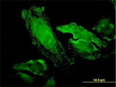 Immunocytochemistry/Immunofluorescence: RPS7 Antibody (3G4) [H00006201-M03] - Analysis of monoclonal antibody to RPS7 on HeLa cell. Antibody concentration 20 ug/ml