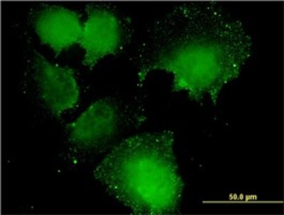 Immunocytochemistry/Immunofluorescence: CNOT7 Antibody (2F6) [H00029883-M01] - Analysis of monoclonal antibody to CNOT7 on HeLa cell. Antibody concentration 40 ug/ml.