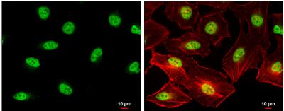 Immunocytochemistry/Immunofluorescence: SIN3B Antibody [NBP2-20367] - HeLa cells were fixed in 4% paraformaldehyde at RT for 15 min. Green: SIN3B protein stained by SIN3B antibody [N1N2], N-term diluted at 1:500. Red: phalloidin, a cytoskeleton marker, diluted at 1:200. Scale bar = 10 um.
