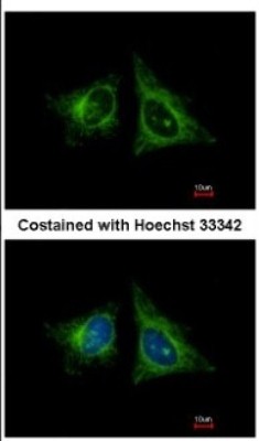 Immunocytochemistry/Immunofluorescence: HEBP1 Antibody [NBP2-14977] - Analysis of methanol-fixed HeLa, using HEBP1 antibody at 1:400 dilution.