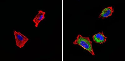 Immunocytochemistry/Immunofluorescence: Somatostatin R4/SSTR4 Antibody [NB100-74539] - Analysis of Somatostatin Receptor 4 (green) showing staining in the cytoplasm of SH-SY5Y cells (right) compared to a negative control without primary antibody (left).
