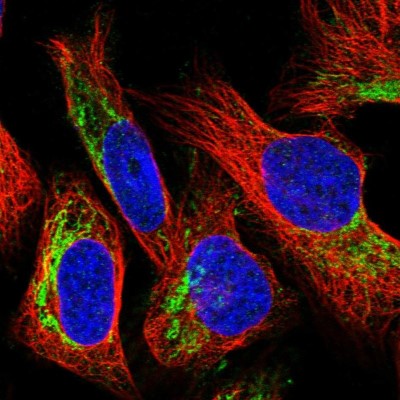 Immunocytochemistry/Immunofluorescence: Hornerin Antibody [NBP1-80807] - Immunofluorescent staining of human cell line U-2 OS shows localization to mitochondria.