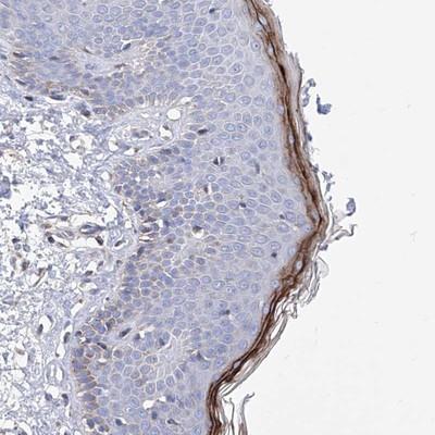 Immunohistochemistry-Paraffin: Hornerin Antibody [NBP1-80807] - Staining of human skin shows distinct positivity in granular layer cells.
