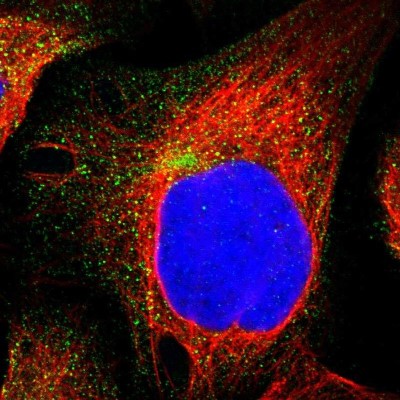 Immunocytochemistry/Immunofluorescence: GULP1/CED-6 Antibody [NBP1-84553] - Immunofluorescent staining of human cell line U-2 OS shows localization to vesicles.