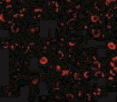 Immunocytochemistry/Immunofluorescence: TLR3 Antibody [NBP1-76659] - Immunofluorescence of TLR3 in El4 cells with TLR3 antibody at 10 ug/mL.
