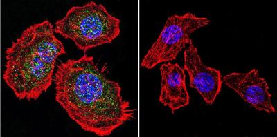 Immunocytochemistry/Immunofluorescence: GR/NR3C1 Antibody [NB300-610] - Analysis of Glucocorticoid Receptor using Glucocorticoid Receptor Polyclonal Antibody shows staining in U251 Cells. Glucocorticoid Receptor (green), F-Actin staining with Phalloidin (red) and nuclei with DAPI (blue) is shown. Cells were grown on chamber slides and fixed with formaldehyde prior to staining. Cells were probed without (control) or with an antibody recognizing Glucocorticoid Receptor at a dilution of 1:20 over night at 4C, washed with PBS and incubated with a DyLight-488 conjugated.