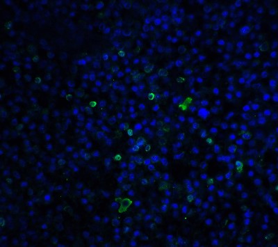 Immunofluorescence: TLR3 Antibody [NBP1-76659] - TLR3 in human spleen tissue with TLR3 antibody at 20 ug/ml.